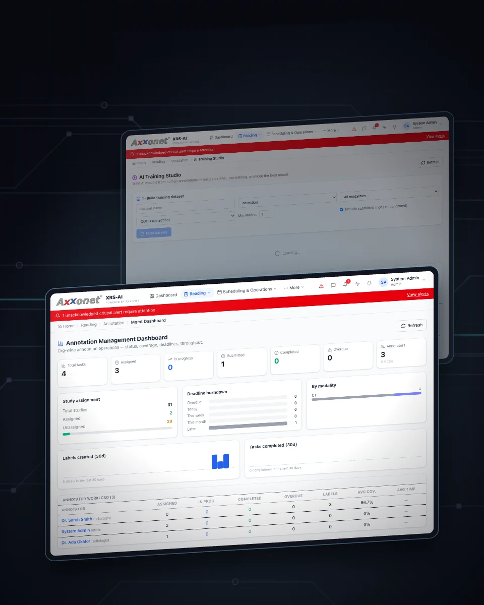 XRS-AI radiology platform dashboards on tilted screens